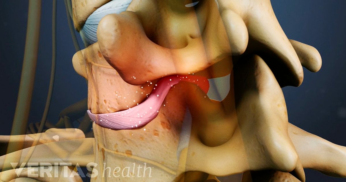 Todo lado del el cuerpo en muscular dolor izquierdo